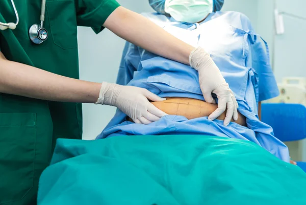 Open Abdominal Surgeries